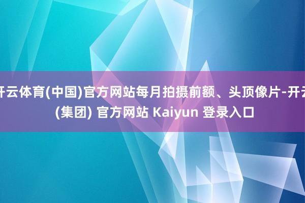 开云体育(中国)官方网站每月拍摄前额、头顶像片-开云 (集团) 官方网站 Kaiyun 登录入口
